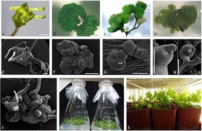 Expression Analyses of Embryogenesis-Associated Genes during Somatic Embryogenesis of Adiantum capillus-veneris L. In vitro: New Insights into the Evolution of Reproductive Organs in Land Plants